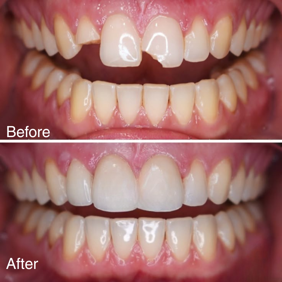 Image gallery marquee