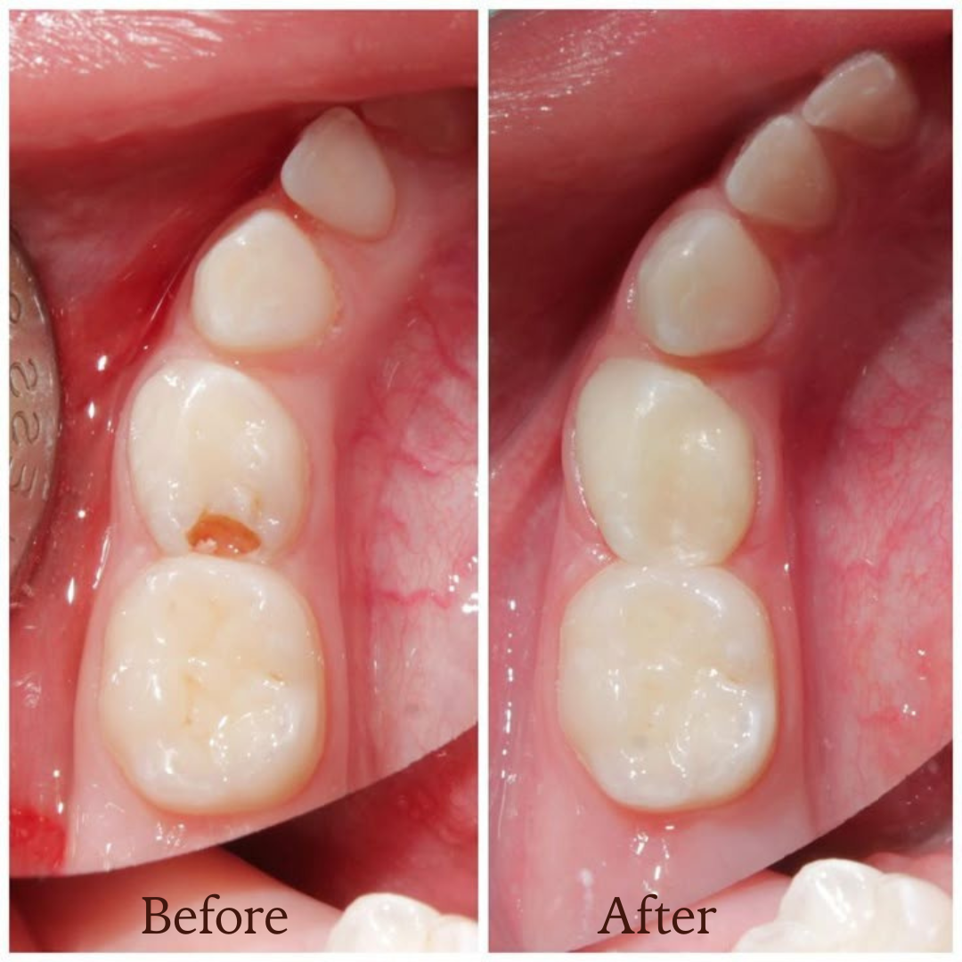 Image gallery marquee