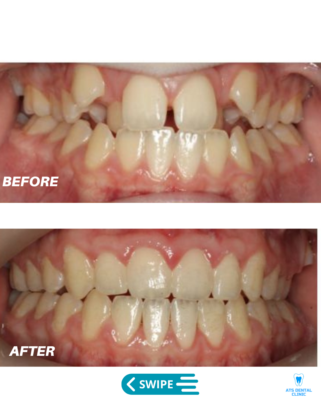 Image gallery marquee