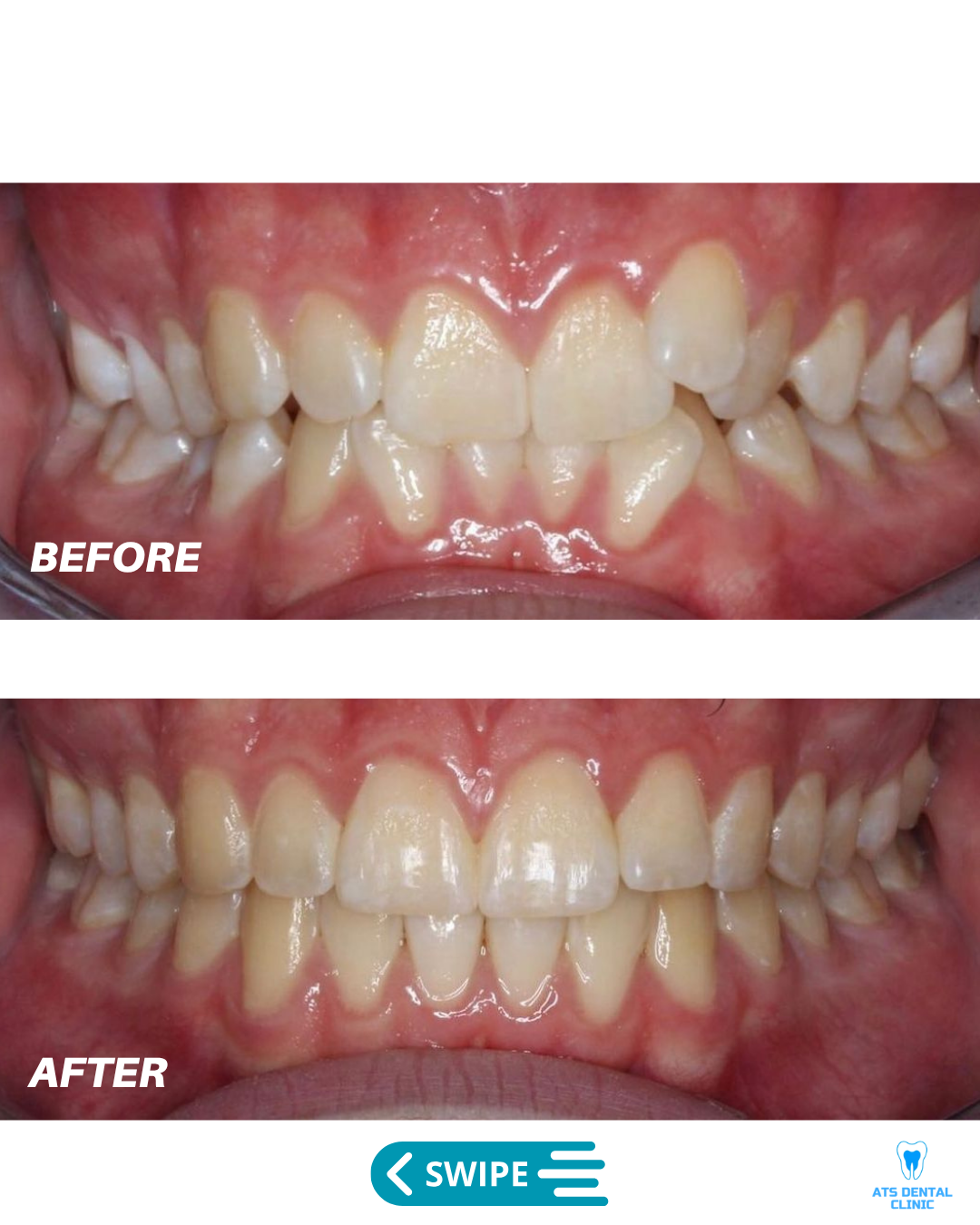 Image gallery marquee