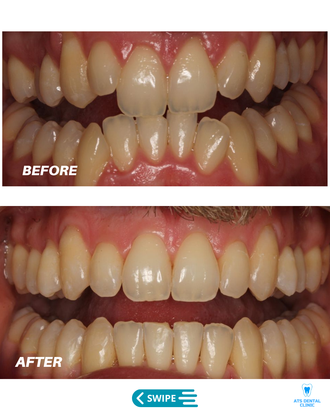 Image gallery marquee