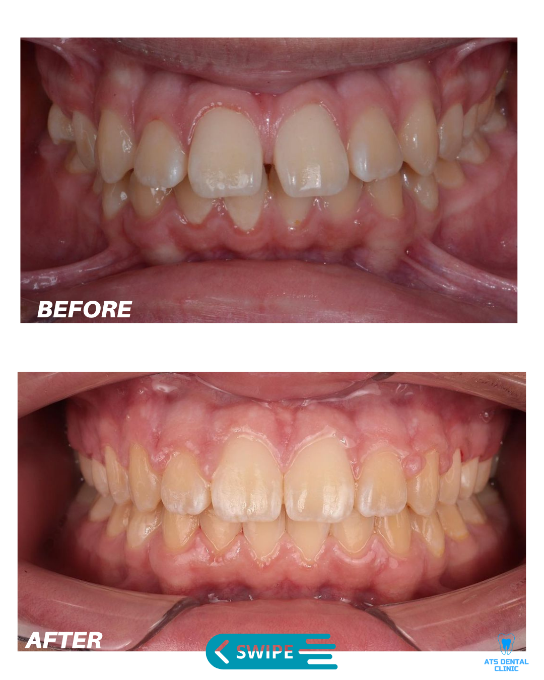 Image gallery marquee