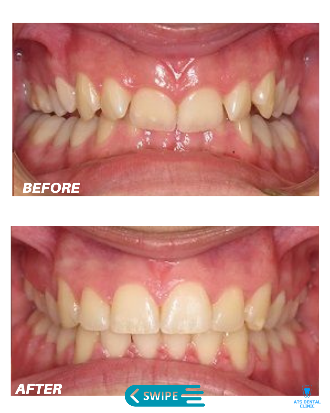 Image gallery marquee