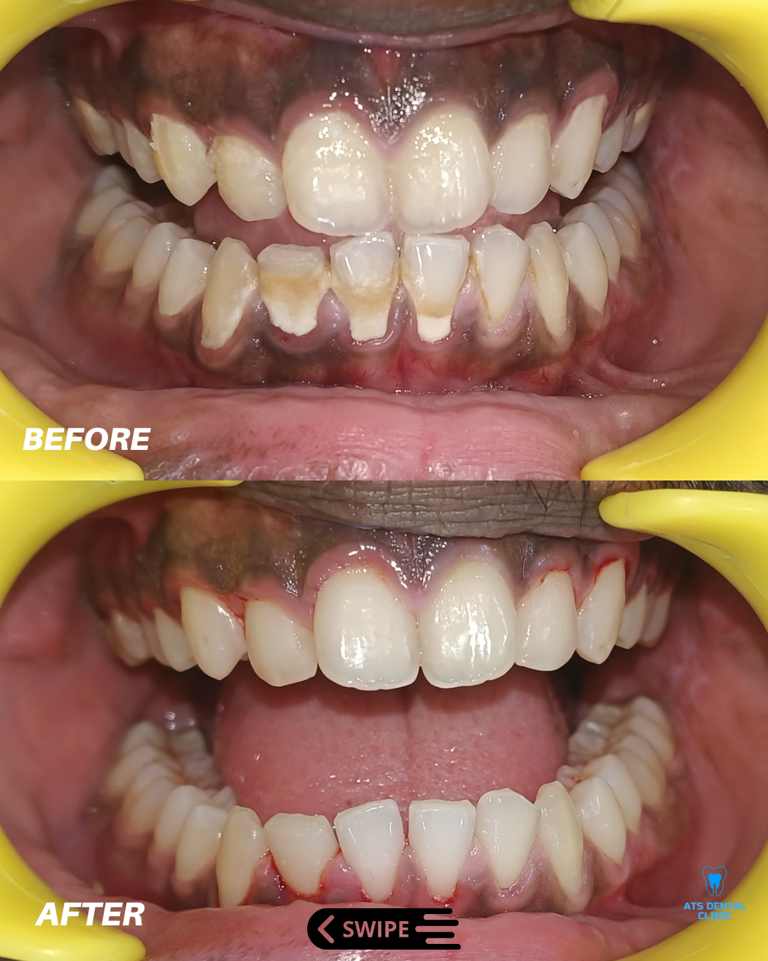 Image gallery marquee