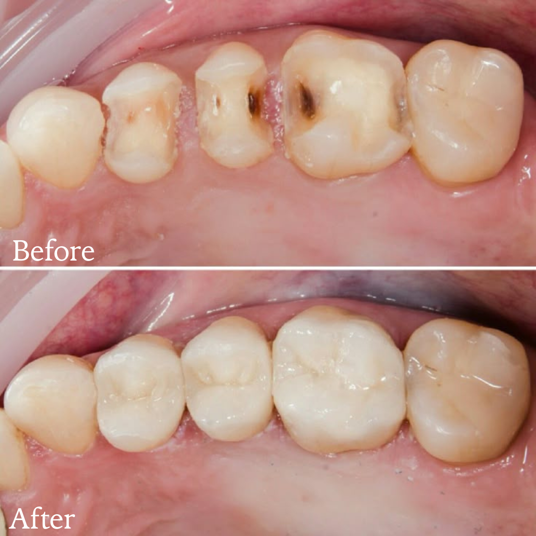 Image gallery marquee