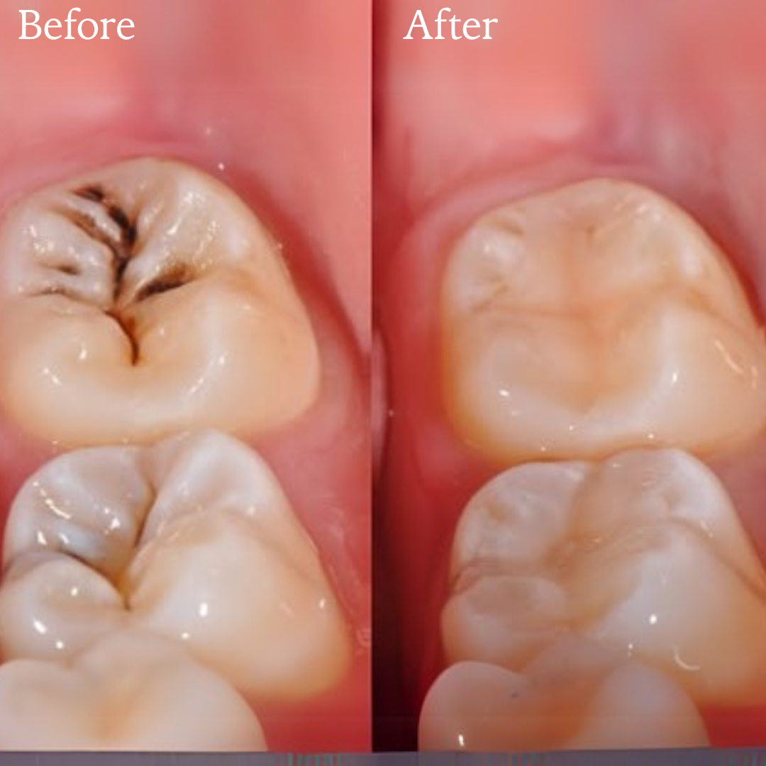 Image gallery marquee