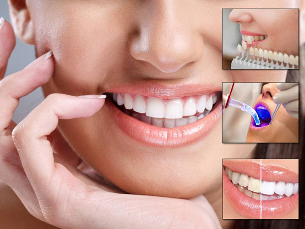 Best Dentist in Thoraipakkam