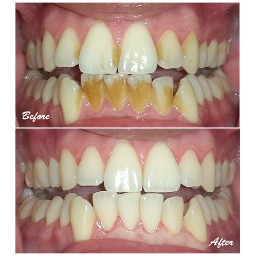 Image gallery marquee