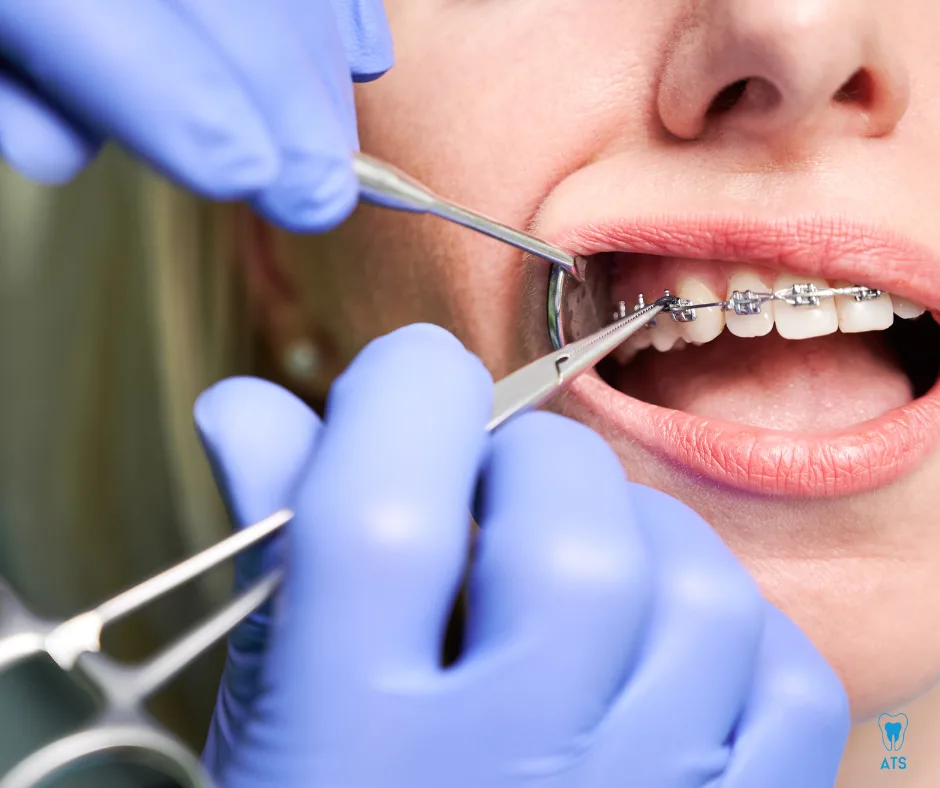 Orthodontist near Thoraipakkam