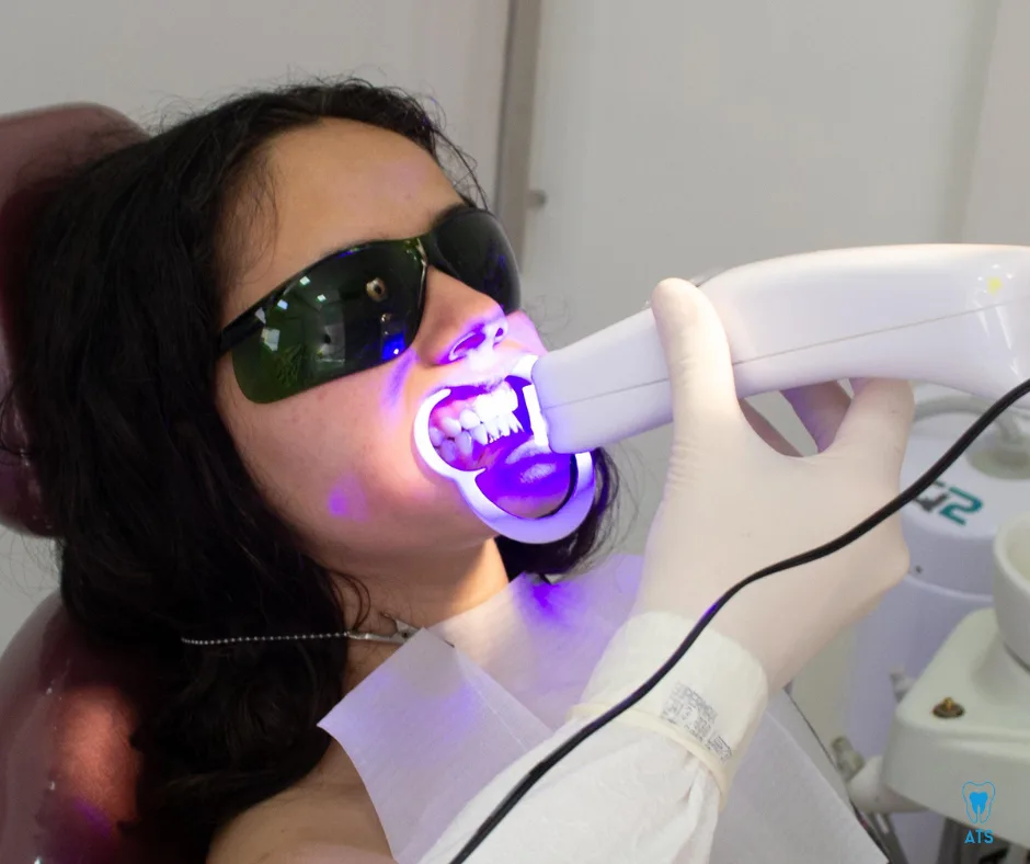 Teeth Whitening treatment in thoraipakkam