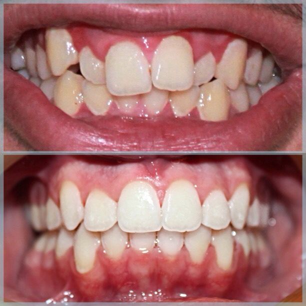 Image gallery marquee